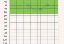 验配助听器的时候为什么要做测听?