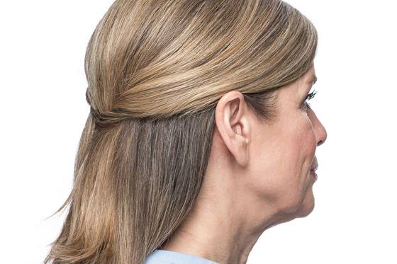 郑州二七区助听器