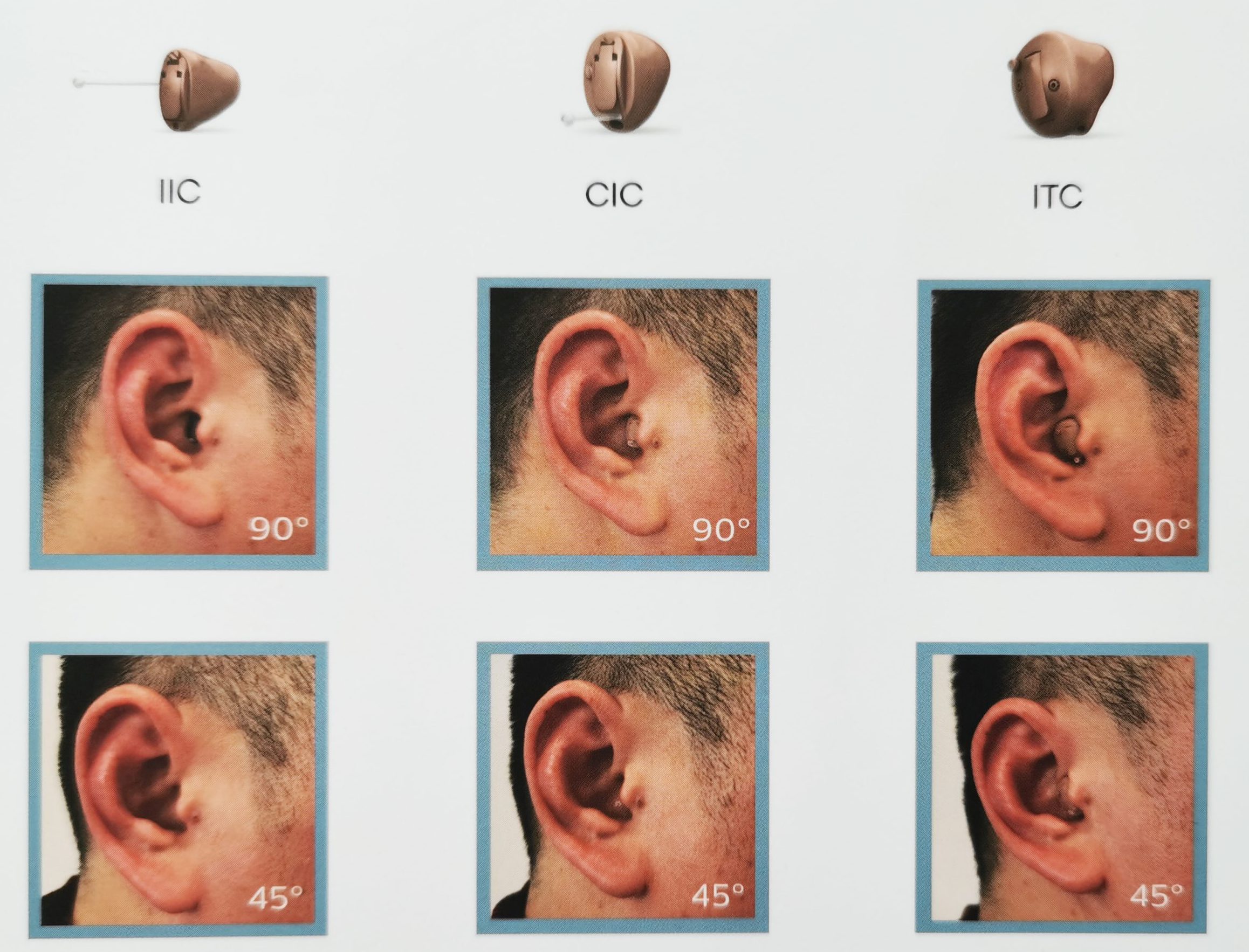 听途ET定制式助听器