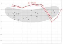 噪声性耳聋听力图