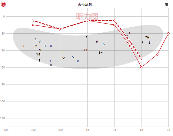 噪声性耳聋听力图