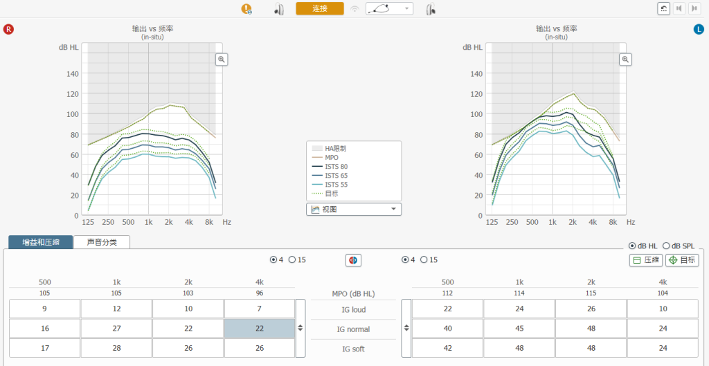 助听器精细调节
